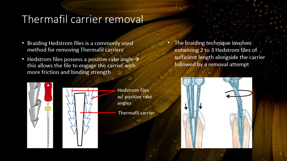 Clinical Case: Re-Treatment of Thermafil Carriers on #14 and #15