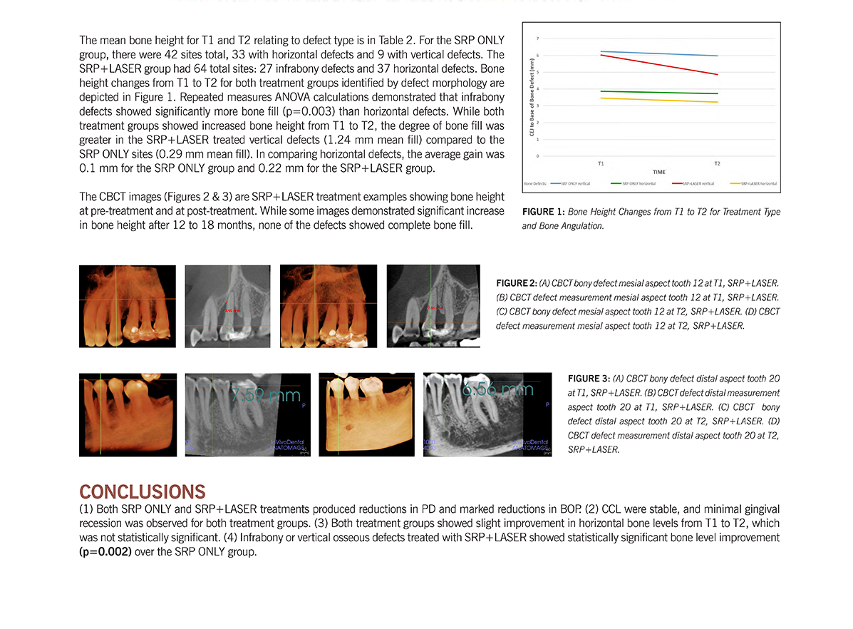 Effectiveness of 1064 Diode Laser Therapy for Treatment of Periodontitis