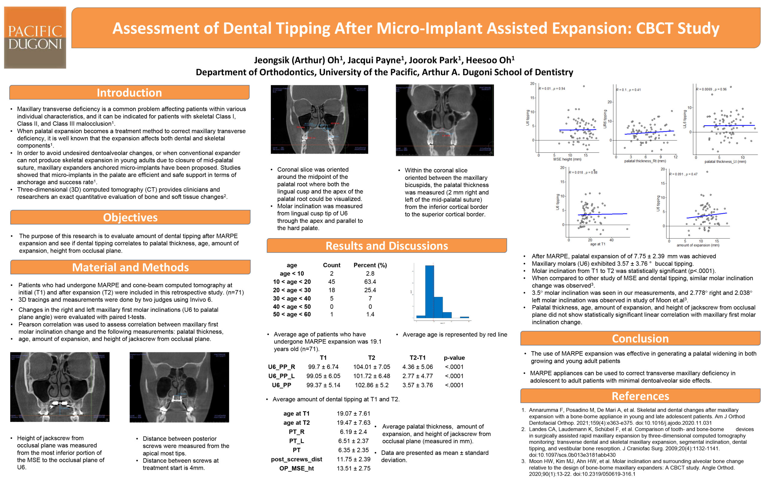 Assessment of Dental Tipping After Micro-Implant Assisted Expansion: CBCT Study