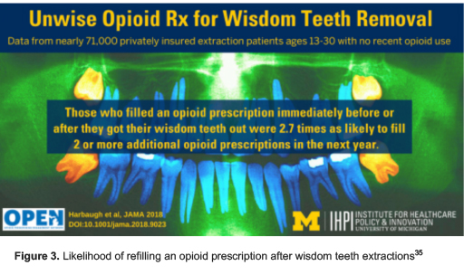 Opioids and Dentistry