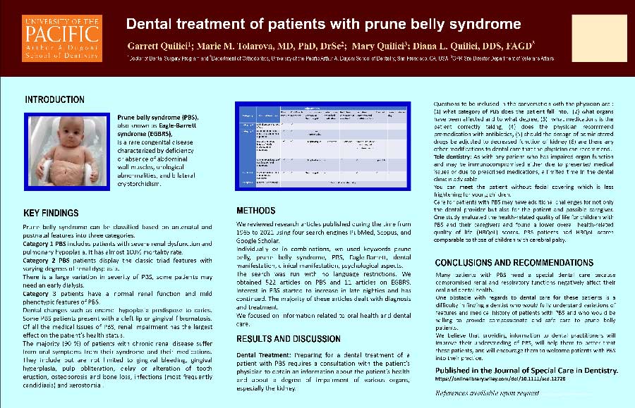 Dental treatment of patients with prune belly syndrome