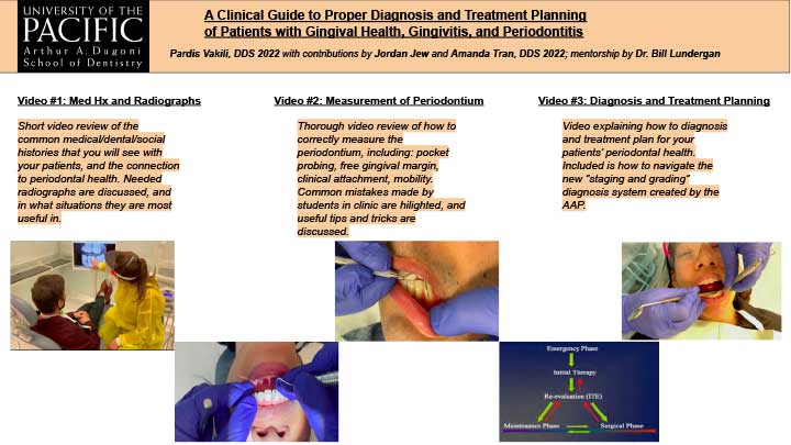 A Clinical Guide to Proper Diagnosis and Treatment Planning of Patients with Gingival Health, Gingivitis, and Periodontitis
