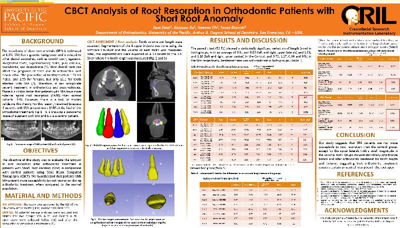 CBCT Analysis of Root Resorption in Orthodontic Patients with Short Root Anomaly