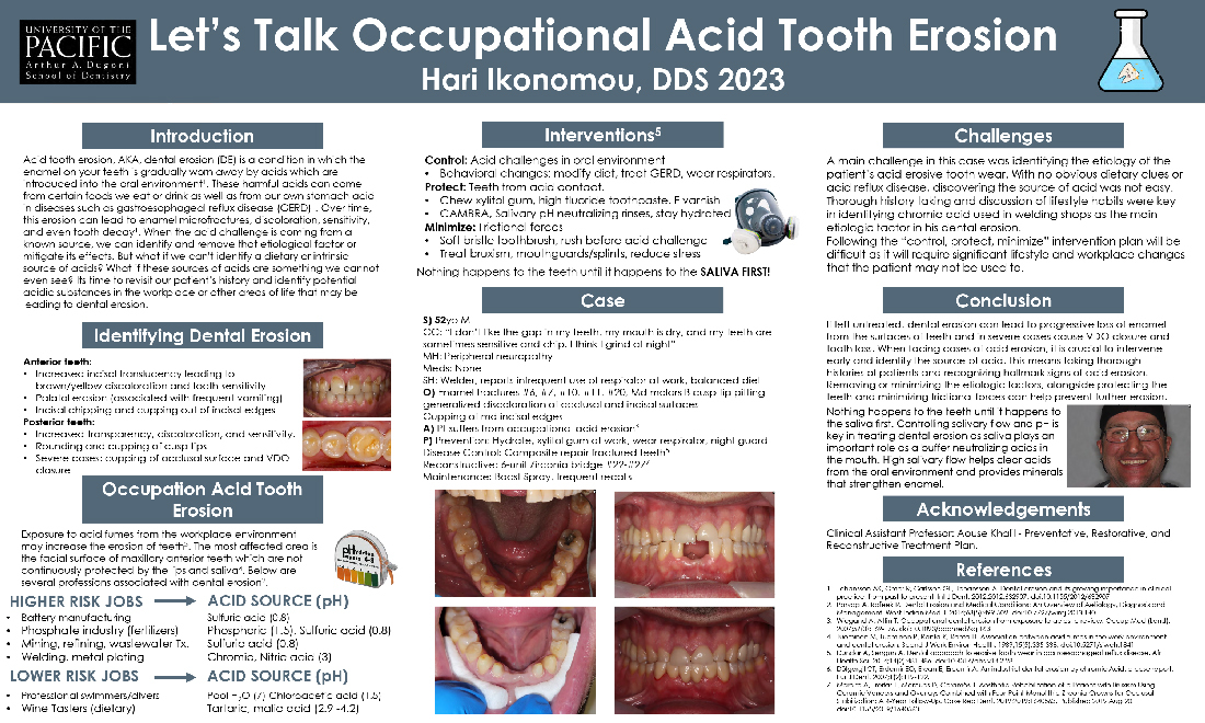 Let’s Talk Occupational Acid Tooth Erosion