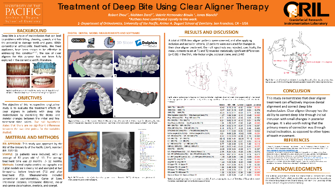 Treatment of Deep Bite Using Clear Aligner Therapy
